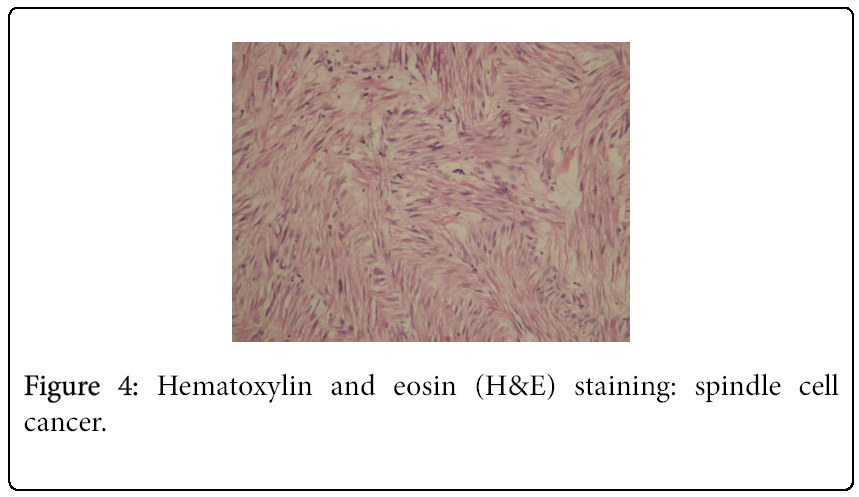cancer-surgery-Hematoxylin