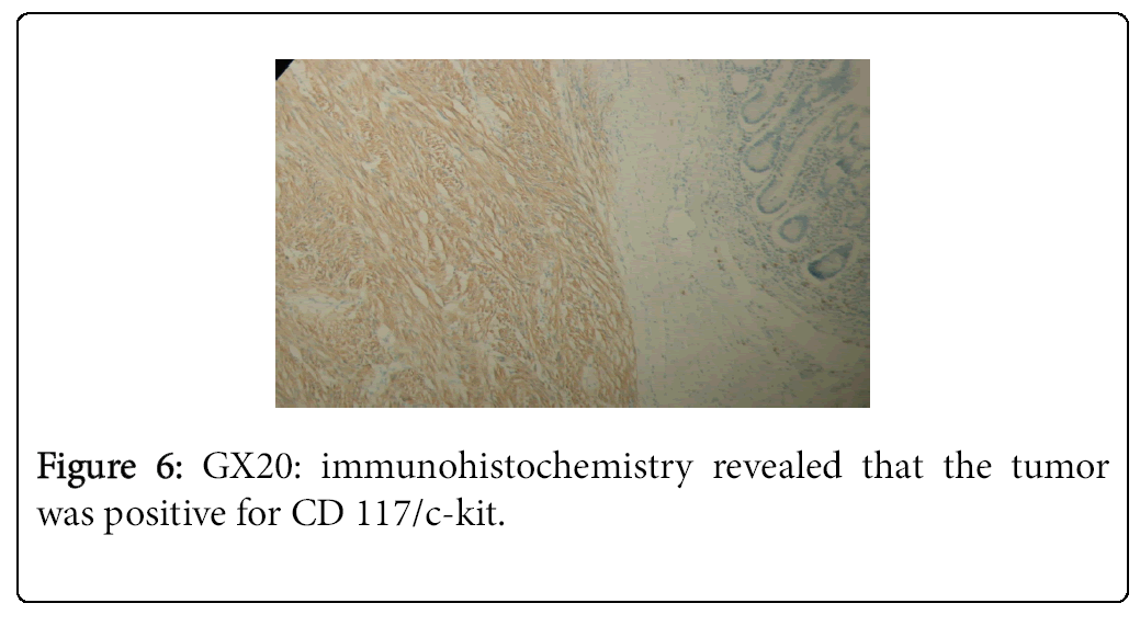 cancer-surgery-immunohistochemistry