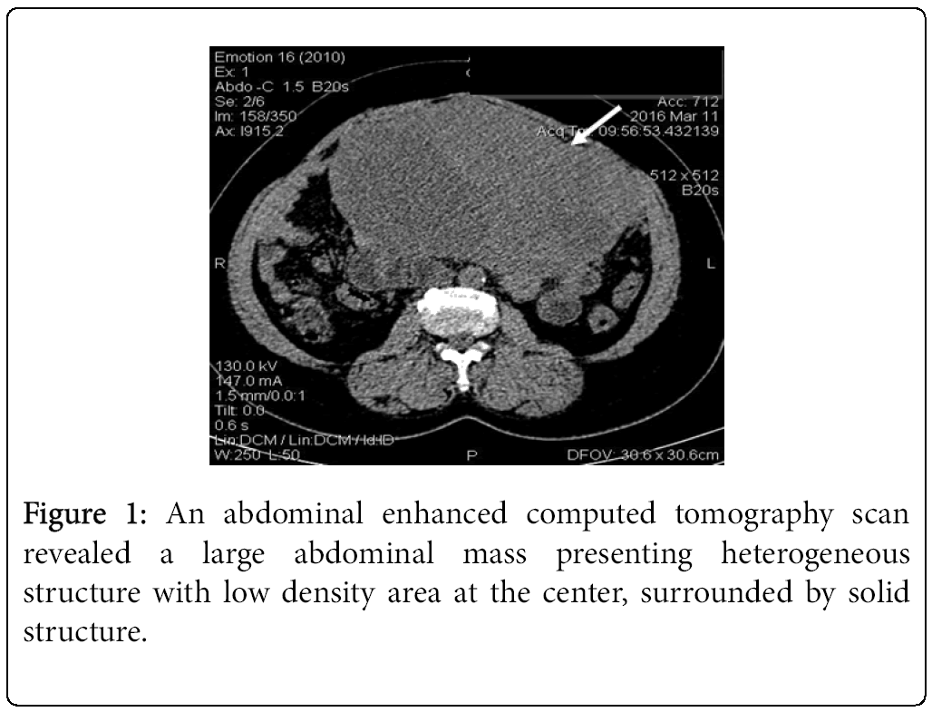 cancer-surgery-tomography