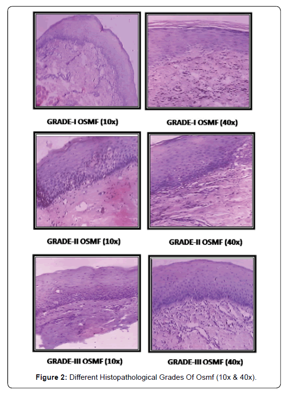carcinogenesismutagenesisHistopathologicalGrades