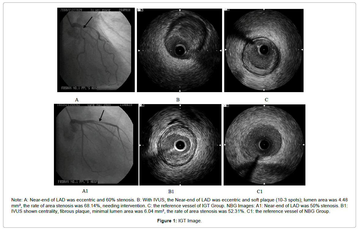cardiovascularpharmacologyIGTImage