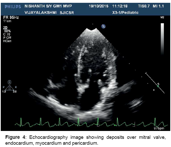 cardiovascular-therapy-echocardiography