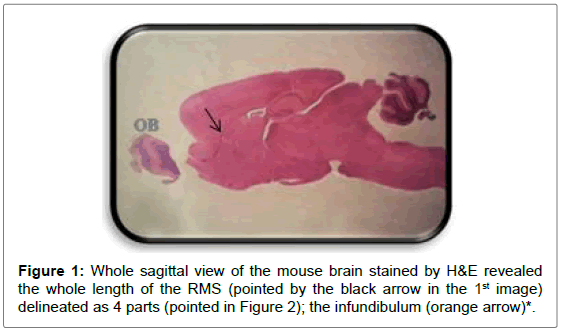 cell-science-apoptosis-sagittal-mouse-brain