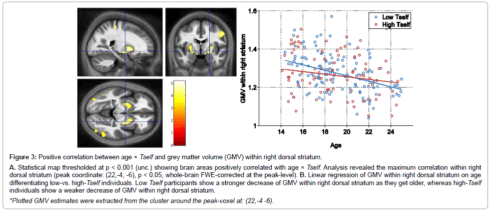 child-and-adolescent-behavior-grey-matter