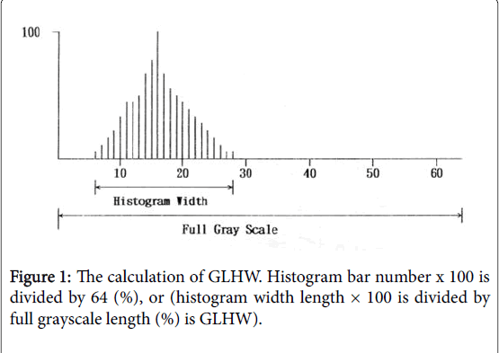 child-health-Histogram-bar