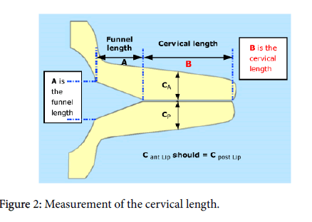 child-health-cervical-length