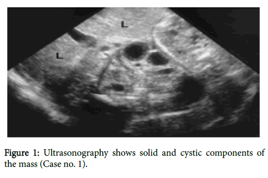 child-health-cystic-components