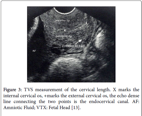 child-health-endocervical-canal