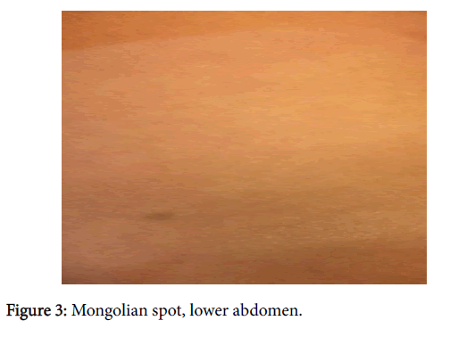 child-health-lower-abdomen