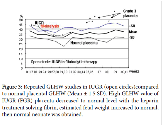 child-health-normal-placental