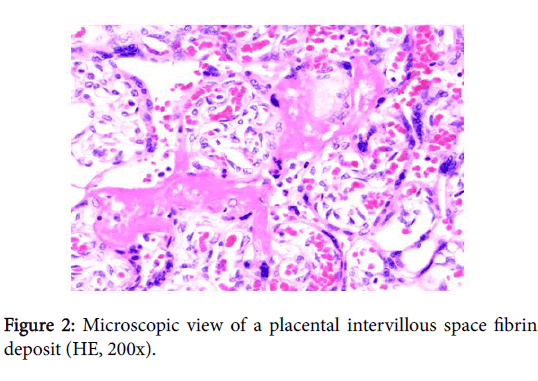 child-health-placental-intervillous