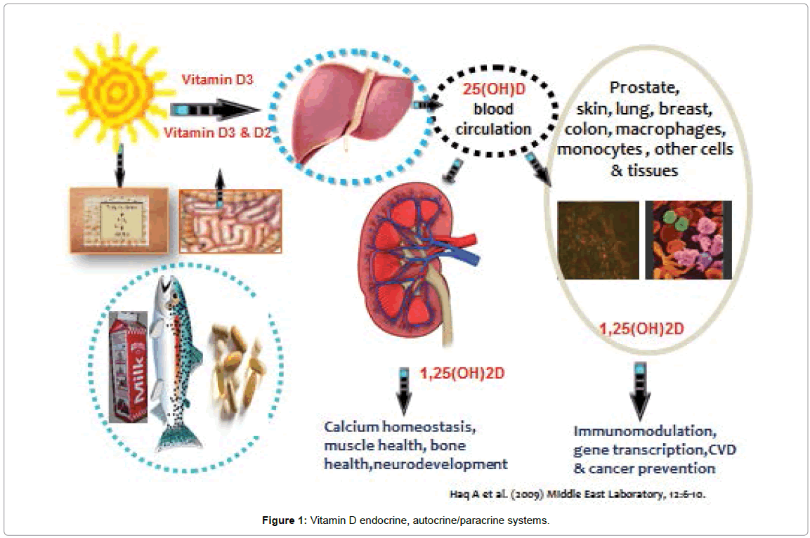 Vitamin D Deficiency Metabolism And Routine Measurement Of