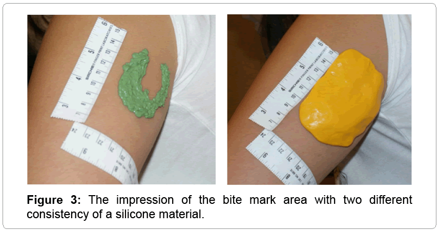 civil-legal-sciences-silicone-material