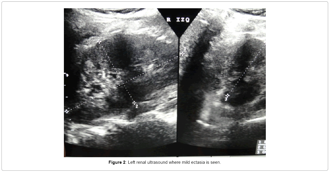 clinicalcasereportsLeftrenal