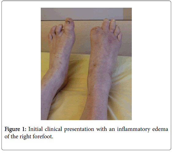 clinical-diabetes-and-practice-Initial-clinical-presentation