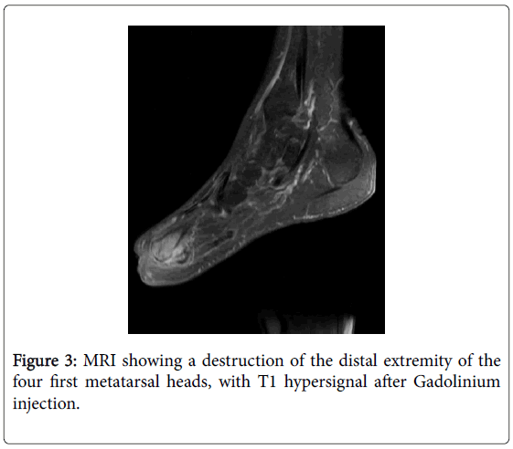 clinical-diabetes-and-practice-MRI-showing