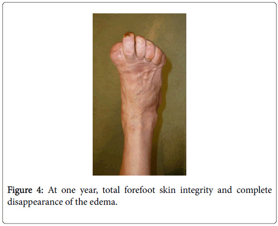 clinical-diabetes-and-practice-forefoot-skin-integrity