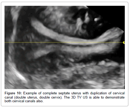 clinical-diagnosis-double-cervix