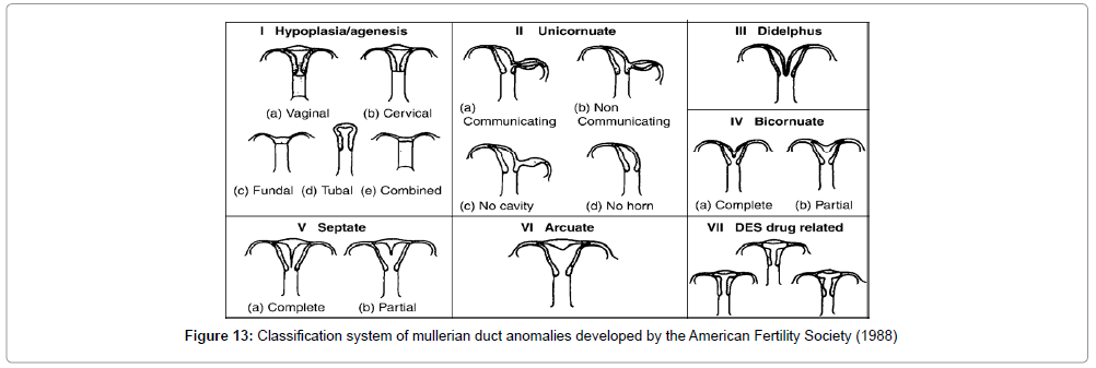 clinical-diagnosis-duct-anomalies