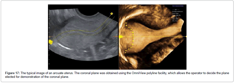 clinical-diagnosis-duct-anomalies