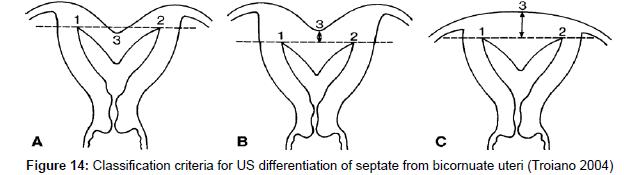 clinical-diagnosis-duct-criteria