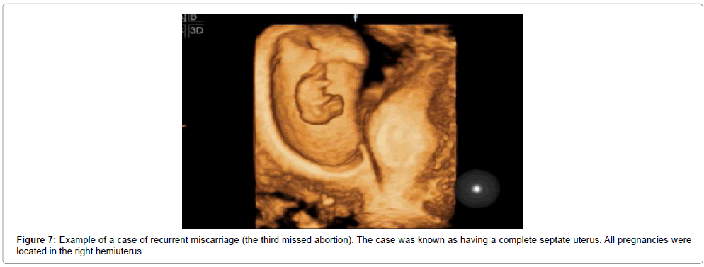 clinical-diagnosis-pregnancies-right