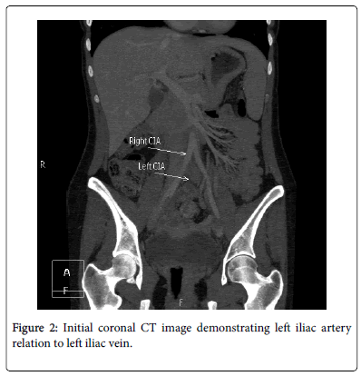 clinical-diagnosis-research-Initial-coronal-CT