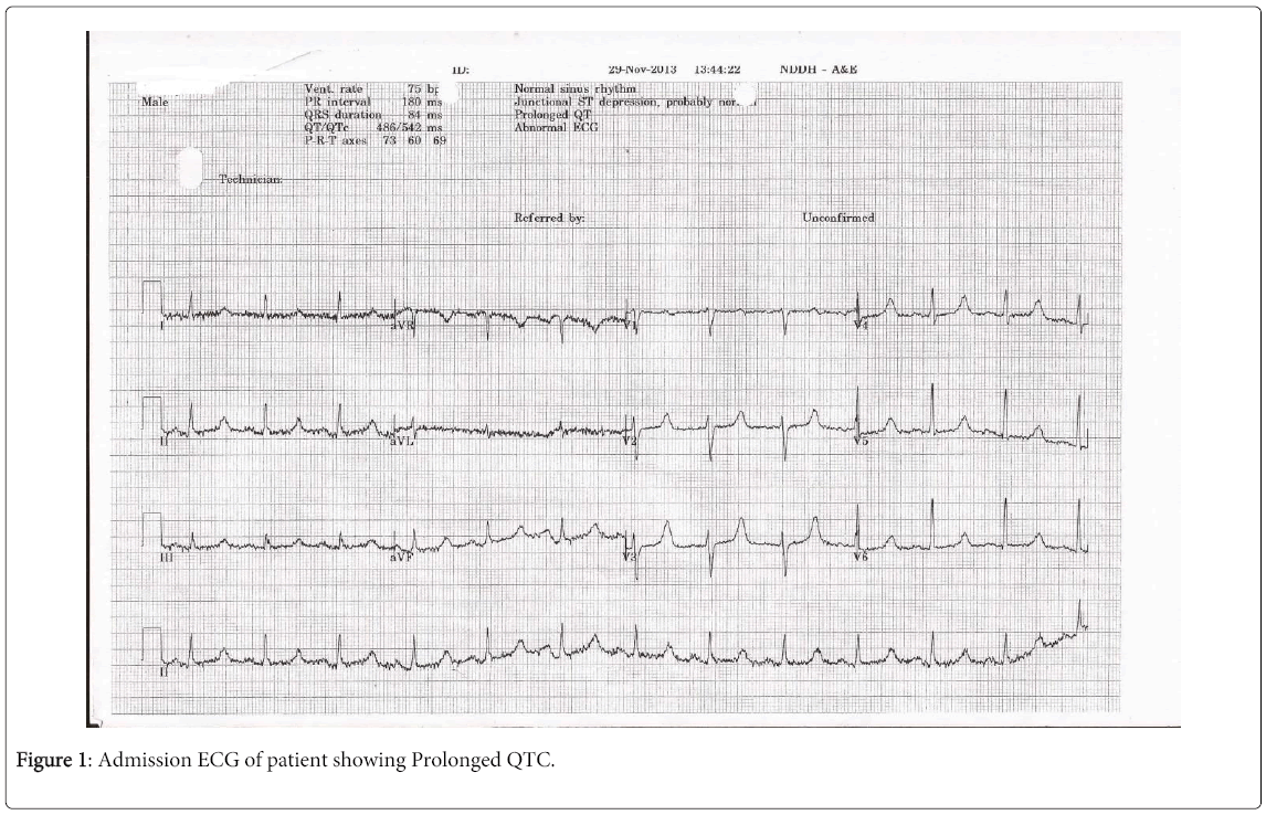 clinical-diagnosis-research-Prolonged-QTC