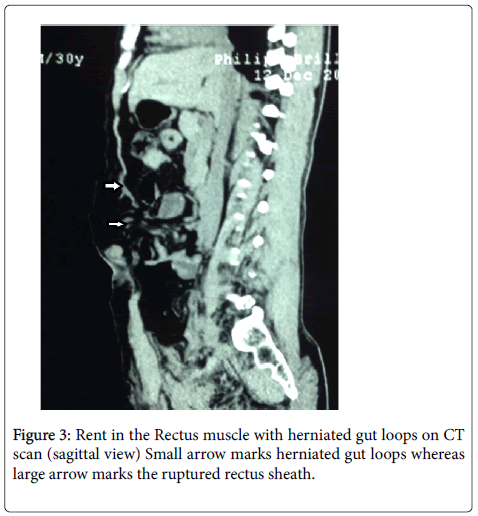 clinical-diagnosis-research-Small-arrow-marks