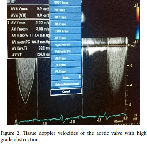 clinical-diagnosis-research-Tissue-doppler-velocities
