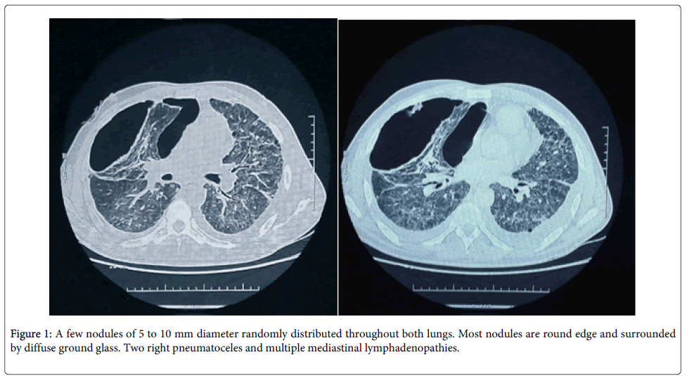 clinical-diagnosis-research-diameter-randomly-distributed