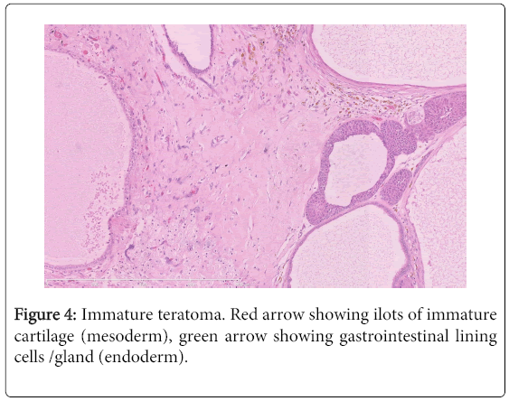 clinical-diagnosis-research-gastrointestinal-lining