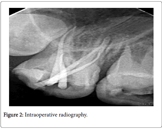 clinical-diagnosis-research-intraoperative-radiography