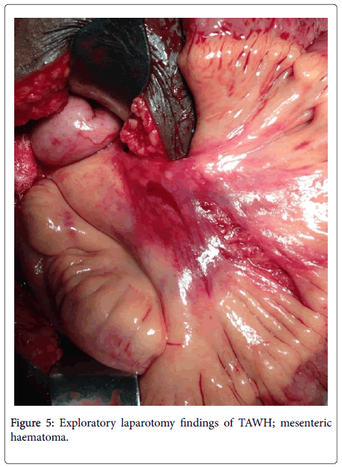 clinical-diagnosis-research-laparotomy-findings