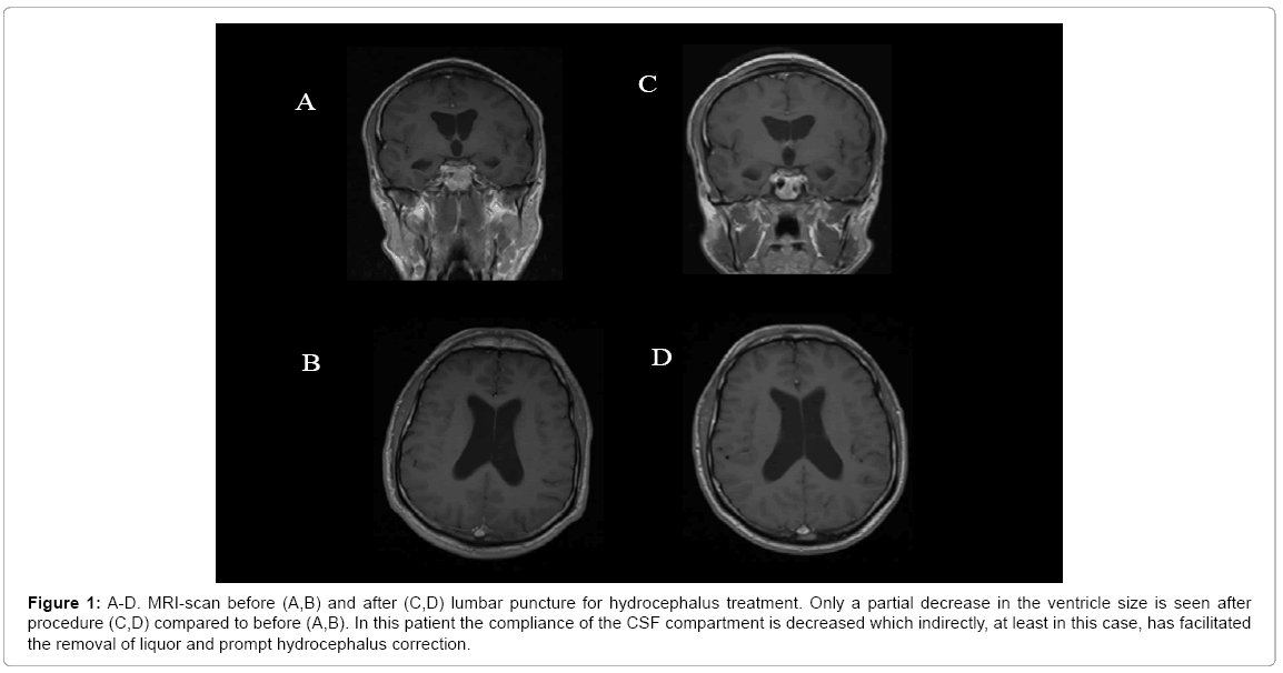 clinical-diagnosis-research-lumbar-puncture
