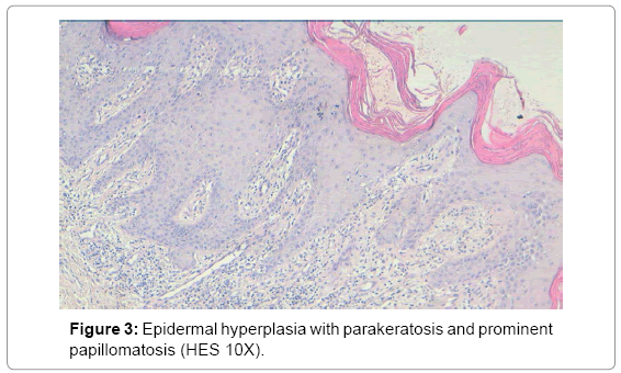 clinical-diagnosis-research-parakeratosis-prominent