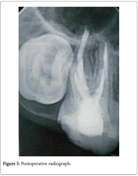 clinical-diagnosis-research-postoperative-radiograph