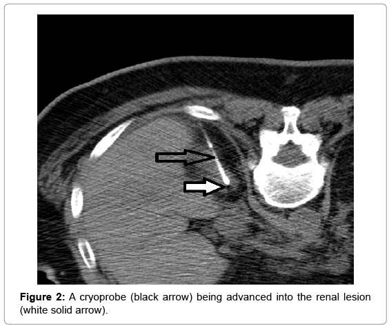clinical-diagnosis-research-renal-lesion