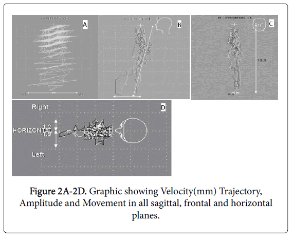 clinical-diagnosis-research-showing-velocity
