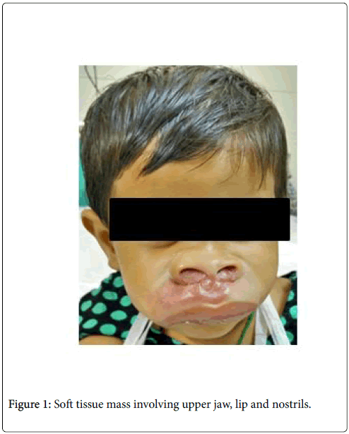 clinical-diagnosis-research-soft-tissue-mass-involving