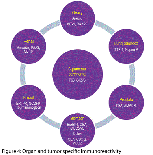 clinical-diagnosis-research-tumor-specific-immunoreactivity