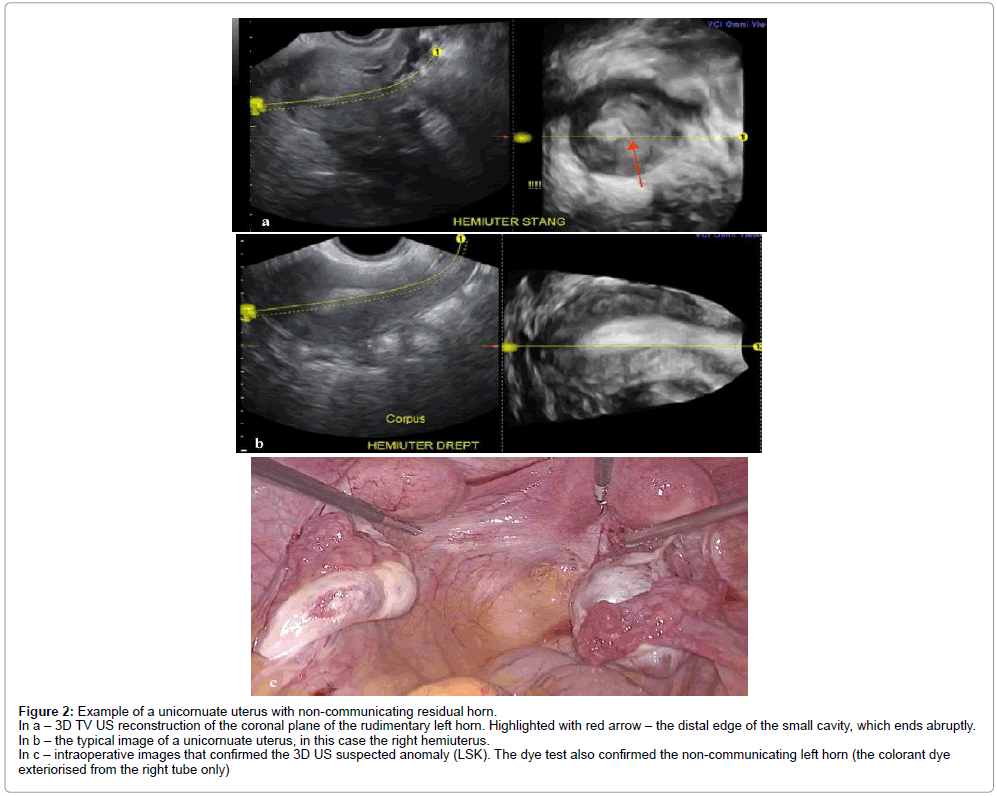 clinical-diagnosis-residual-horn