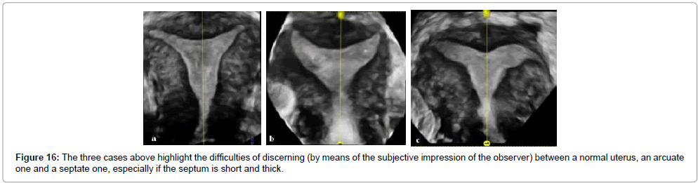 clinical-diagnosis-short-thick