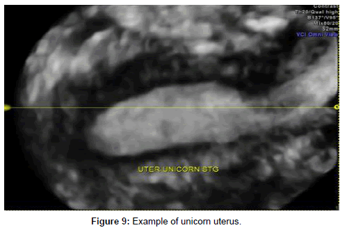 clinical-diagnosis-unicorn-uterus