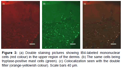 Bandeiraea Simplicifolia Isolectin B4 Binds Mast Cells in Human Skin