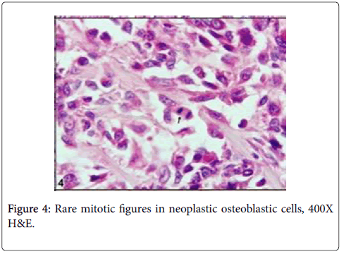 clinical-experimental-mitotic-neoplastic