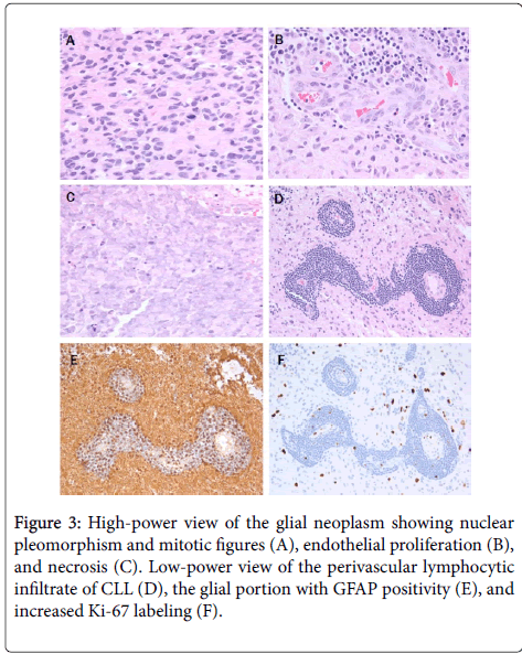 clinical-experimental-neoplasm