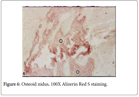 clinical-experimental-nidus-staining