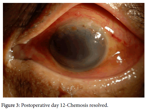 Clinical Experimental Ophthalmology Postoperative Day Clinical Experimental Ophthalmology Postoperative Day