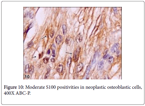 clinical-experimental-osteoblastic